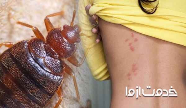 جای گزش ساس